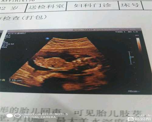 上海靠谱的代怀孕哪家好_卵巢早衰代怀孕电话