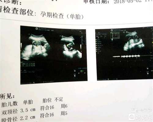 代孕哪里有_广州代怀孕包性别_上海代怀孕可靠