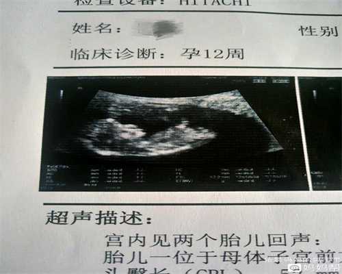 哪家医院只做助孕手术_助孕自选性别_泰国试管婴儿怀双胞胎风险大吗？